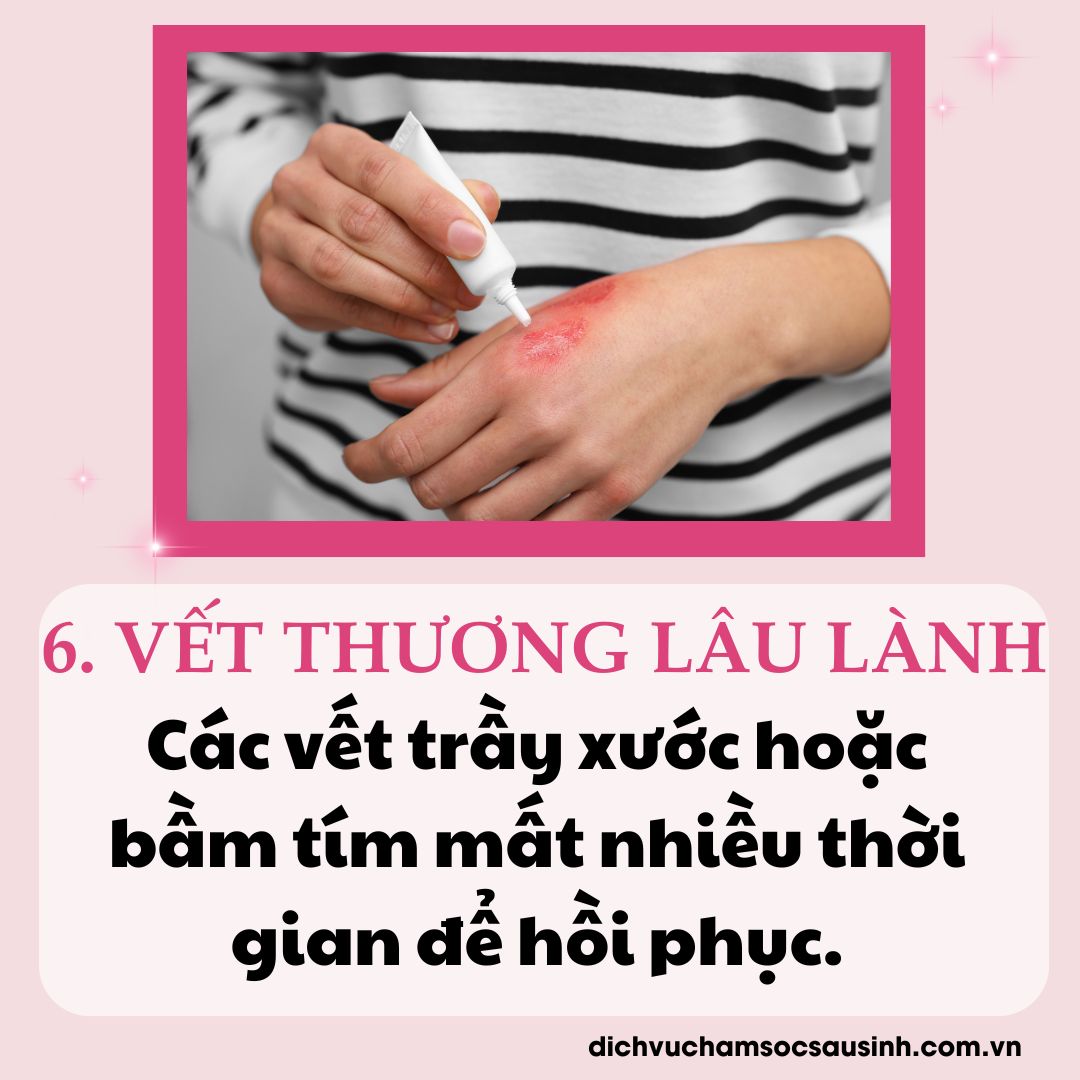 Vết thương lâu lành khi bị tiểu đường thai kỳ